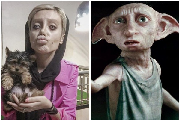 Cô gái phẫu thuật thẩm mỹ hơn 50 lần để nhìn giống Angelina Jolie, kết quả trả về gia tinh Dobby